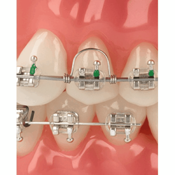 ressort en torque utilisation